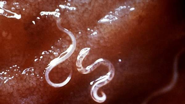 Parasitismo gusanos intestinales